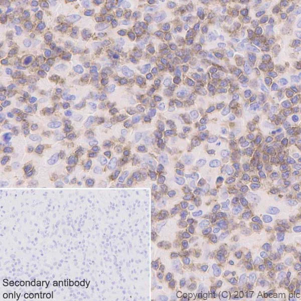 Immunohistochemistry (Formalin/PFA-fixed paraffin-embedded sections) - Anti-Lck antibody [Y123] - BSA and Azide free (AB247239)