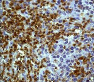 Immunohistochemistry (Formalin/PFA-fixed paraffin-embedded sections) - Anti-Lck antibody [Y123] - BSA and Azide free (ab247239), expandable thumbnail