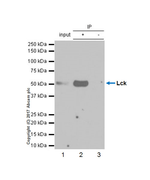 Immunoprecipitation - Anti-Lck antibody [Y123] - BSA and Azide free (AB247239), expandable thumbnail