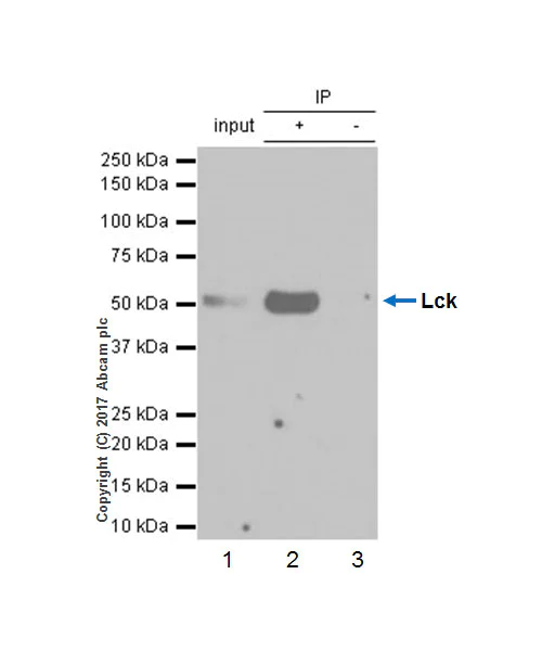 Immunoprecipitation - Anti-Lck antibody [Y123] - BSA and Azide free (AB247239)