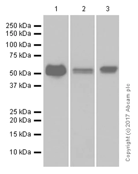 Western blot - Anti-Lck antibody [Y123] - BSA and Azide free (AB247239)