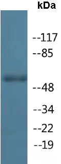 Western blot - Anti-Lck (phospho Y191) antibody (AB138524)