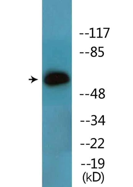 Western blot - Anti-Lck (phospho Y393) antibody (AB138442)