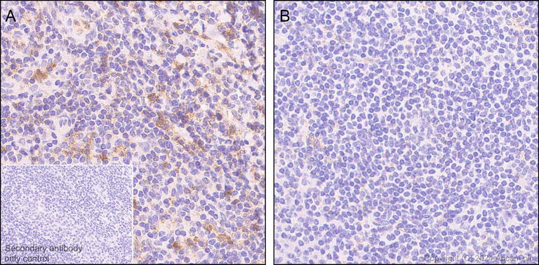 Immunohistochemistry (Formalin/PFA-fixed paraffin-embedded sections) - Anti-Lck (phospho Y394) antibody [EPR27974-93] - BSA and Azide free (AB318961)
