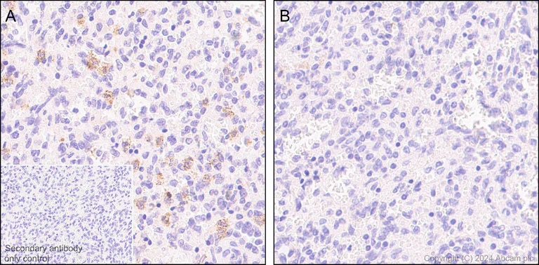 Immunohistochemistry (Formalin/PFA-fixed paraffin-embedded sections) - Anti-Lck (phospho Y394) antibody [EPR27974-93] - BSA and Azide free (AB318961)