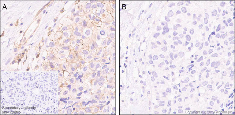 Immunohistochemistry (Formalin/PFA-fixed paraffin-embedded sections) - Anti-Lck (phospho Y394) antibody [EPR27974-93] - BSA and Azide free (AB318961)