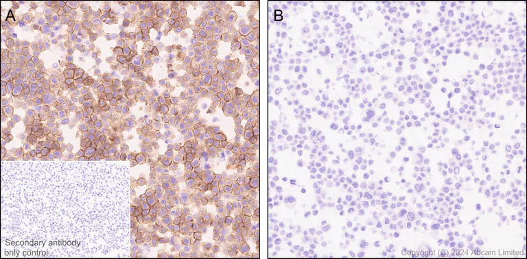 Immunohistochemistry (Formalin/PFA-fixed paraffin-embedded sections) - Anti-Lck (phospho Y394) antibody [EPR27974-93] - BSA and Azide free (AB318961)
