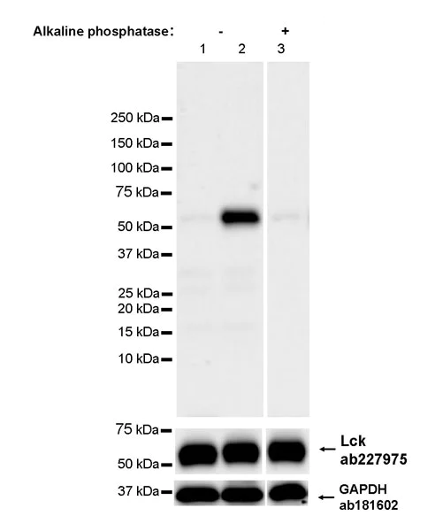 Western blot - Anti-Lck (phospho Y394) antibody [EPR27974-93] - BSA and Azide free (AB318961)