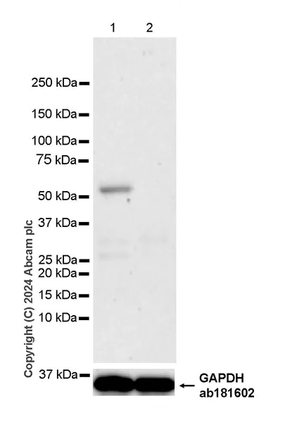 Western blot - Anti-Lck (phospho Y394) antibody [EPR27974-93] - BSA and Azide free (AB318961)