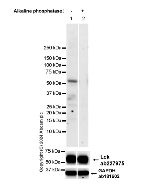 Western blot - Anti-Lck (phospho Y394) antibody [EPR27974-93] - BSA and Azide free (AB318961)