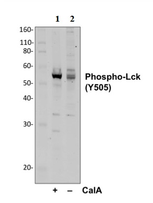 Western blot - Anti-Lck (phospho Y505) antibody [LckY505-A3] (AB278722)