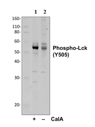 Western blot - Anti-Lck (phospho Y505) antibody [LckY505-A3] (AB278722)