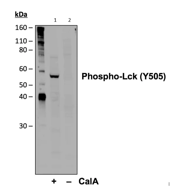Western blot - Anti-Lck (phospho Y505) antibody [LckY505-A3] (AB278722)