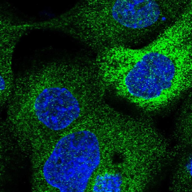 Immunocytochemistry - Anti-LCLAT1 antibody (AB122197), expandable thumbnail