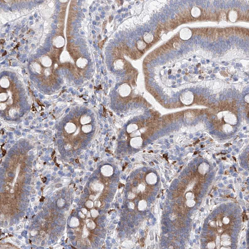 Immunohistochemistry (Formalin/PFA-fixed paraffin-embedded sections) - Anti-LCLAT1 antibody (AB122197), expandable thumbnail