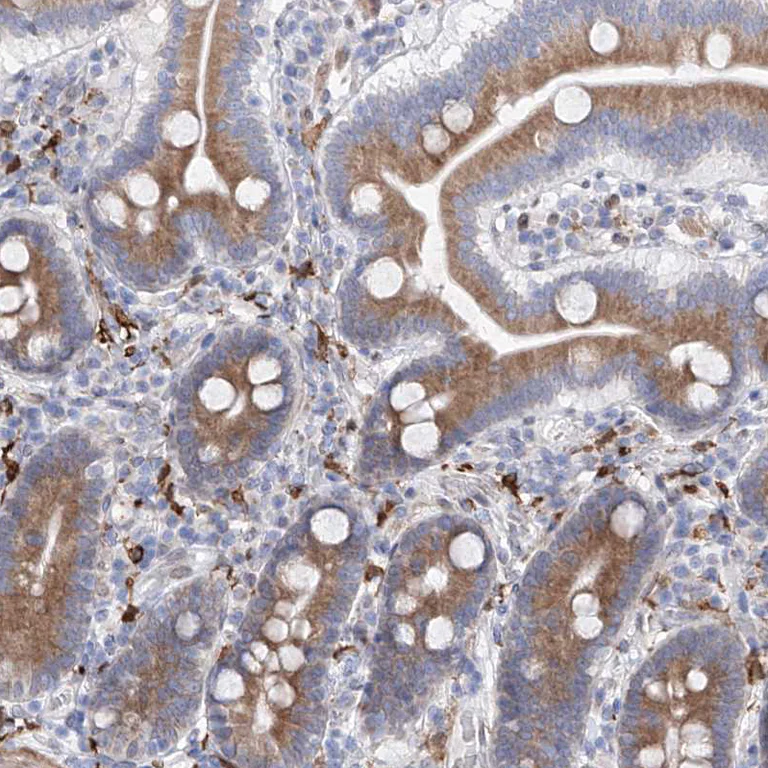 Immunohistochemistry (Formalin/PFA-fixed paraffin-embedded sections) - Anti-LCLAT1 antibody (AB122197)