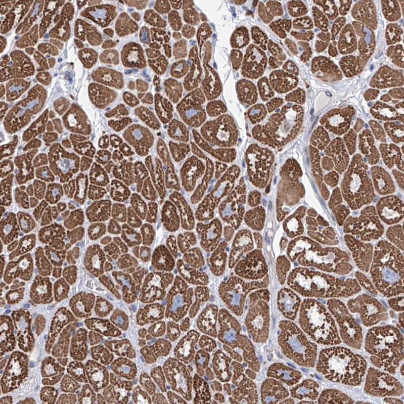 Immunohistochemistry (Formalin/PFA-fixed paraffin-embedded sections) - Anti-LCLAT1 antibody (AB122197), expandable thumbnail