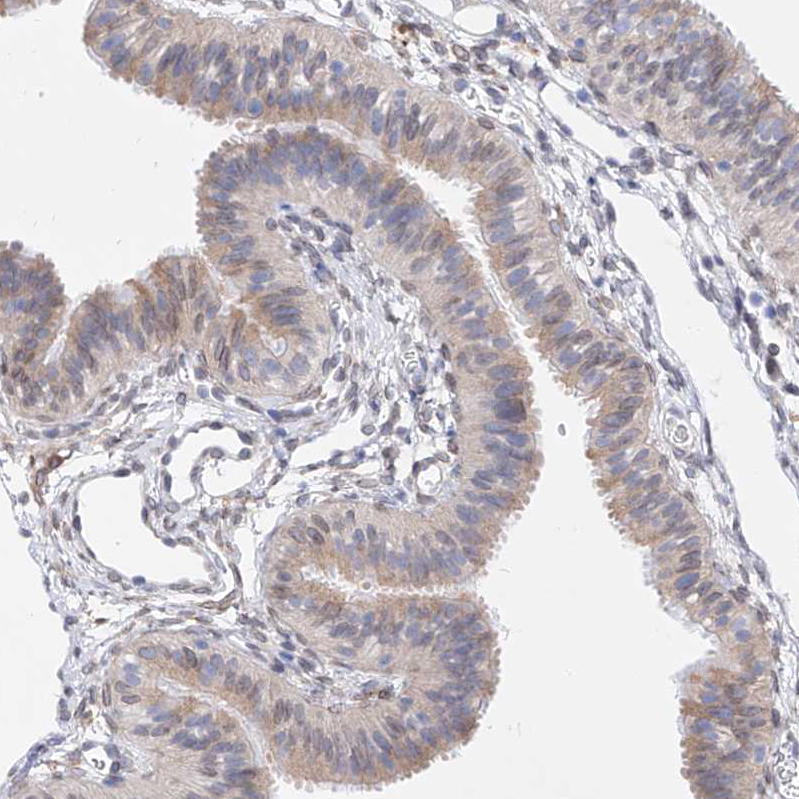 Immunohistochemistry (Formalin/PFA-fixed paraffin-embedded sections) - Anti-LCLAT1 antibody (AB122197), expandable thumbnail
