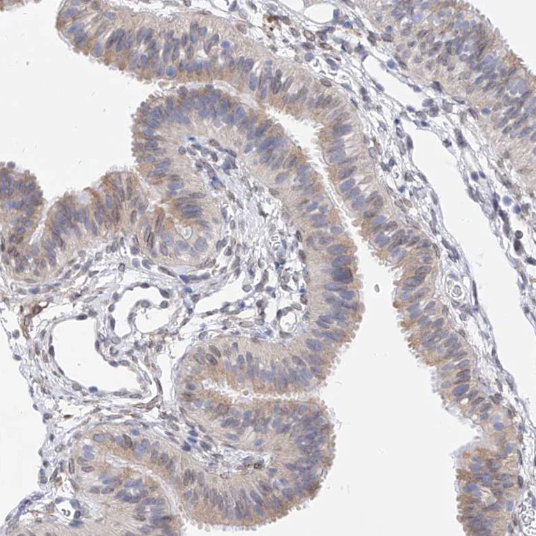 Immunohistochemistry (Formalin/PFA-fixed paraffin-embedded sections) - Anti-LCLAT1 antibody (AB122197)