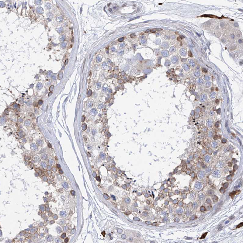 Immunohistochemistry (Formalin/PFA-fixed paraffin-embedded sections) - Anti-LCLAT1 antibody (AB122197), expandable thumbnail