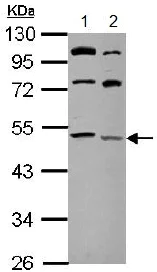 Western blot - Anti-LCLAT1 antibody (AB153987)