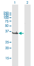 Western blot - Anti-LCMT1 antibody (AB169337)