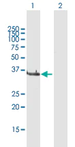 Western blot - Anti-LCMT1 antibody (AB169337)
