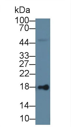 Western blot - Anti-LCN1 antibody (AB232995)
