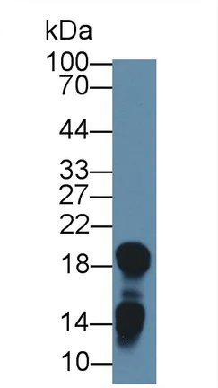 Western blot - Anti-LCN1 antibody (AB232995)