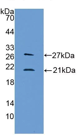 Western blot - Anti-LCN1 antibody (AB232995)
