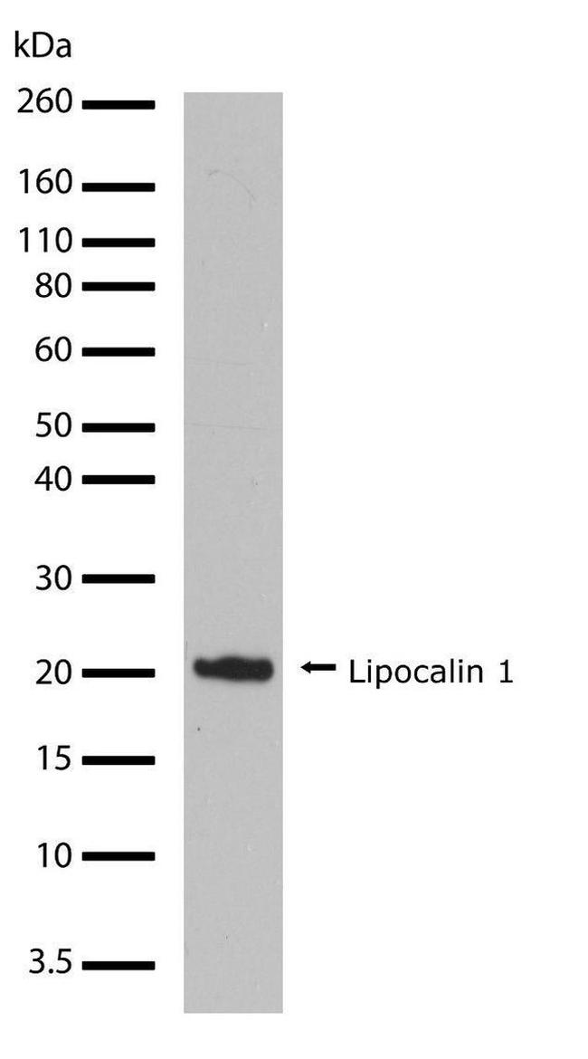 Western blot - Anti-LCN1 Antibody [RP23040084] (AB308004), expandable thumbnail