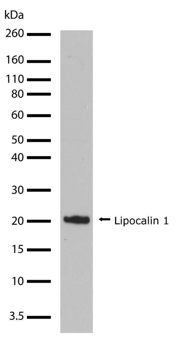 Western blot - Anti-LCN1 Antibody [RP23040084] (AB308004)