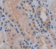 Immunohistochemistry (Formalin/PFA-fixed paraffin-embedded sections) - Anti-LCN12 antibody (AB231146)