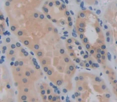 Immunohistochemistry (Formalin/PFA-fixed paraffin-embedded sections) - Anti-LCN12 antibody (AB231146)