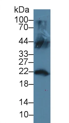 Western blot - Anti-LCN12 antibody (AB231146)