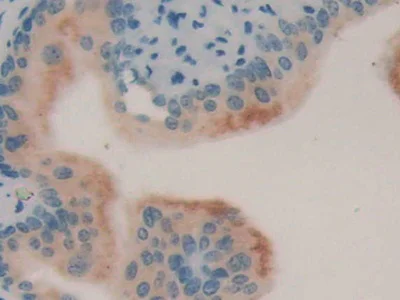 Immunohistochemistry (Formalin/PFA-fixed paraffin-embedded sections) - Anti-LCN8 antibody (AB233510)