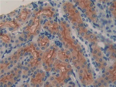 Immunohistochemistry (Formalin/PFA-fixed paraffin-embedded sections) - Anti-LCN8 antibody (AB233510)