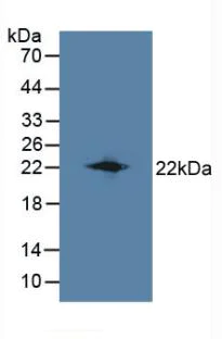 Western blot - Anti-LCN8 antibody (AB233510)