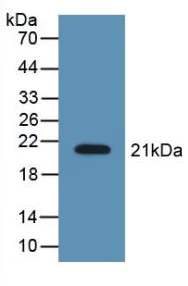 Western blot - Anti-LCN8 antibody (AB233510)