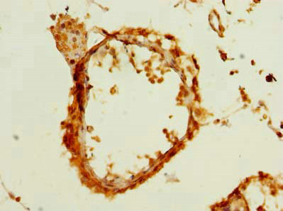 Immunohistochemistry (Formalin/PFA-fixed paraffin-embedded sections) - Anti-LDAH antibody (AB235340)