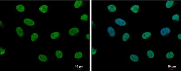 Immunocytochemistry/ Immunofluorescence - Anti-LDB1 antibody (AB96799)