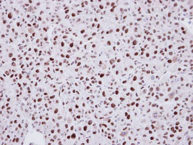 Immunohistochemistry (Formalin/PFA-fixed paraffin-embedded sections) - Anti-LDB1 antibody (AB96799)