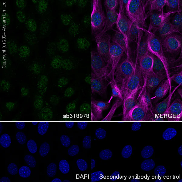 Immunocytochemistry/ Immunofluorescence - Anti-LDB1 antibody [EPR28912-75] (AB318978)