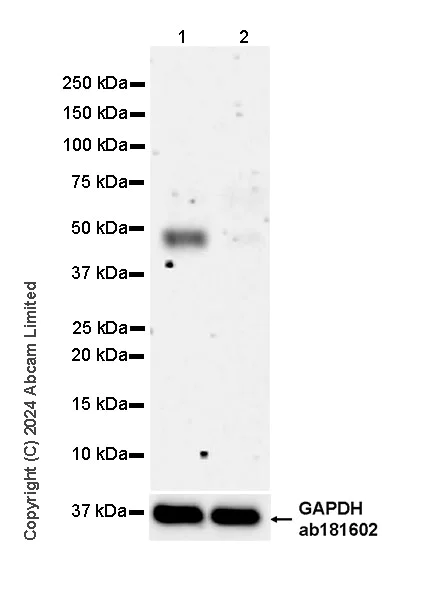 Western blot - Anti-LDB1 antibody [EPR28912-75] (AB318978)