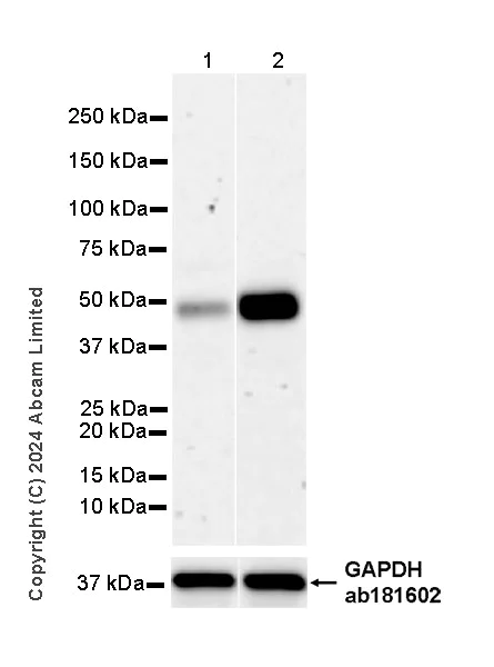 Western blot - Anti-LDB1 antibody [EPR28912-75] (AB318978)
