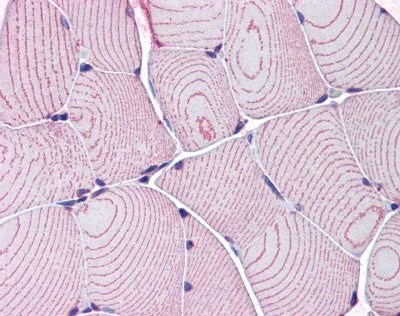 Immunohistochemistry (Formalin/PFA-fixed paraffin-embedded sections) - Anti-LDB3 antibody (AB110003)