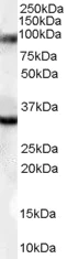 Western blot - Anti-LDB3 antibody (AB110003)