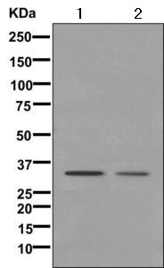 Western blot - Anti-LDB3 antibody [EPR10126] - BSA and Azide free (AB249656)