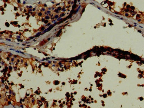 Immunohistochemistry (Formalin/PFA-fixed paraffin-embedded sections) - Anti-LDH-C antibody (AB222910)
