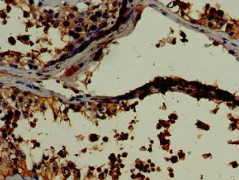 Immunohistochemistry (Formalin/PFA-fixed paraffin-embedded sections) - Anti-LDH-C antibody (AB222910)